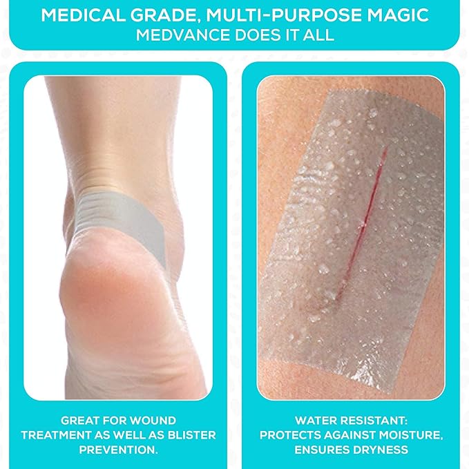 MedVance Silicone Tape 2" Wide Soft - Image 6